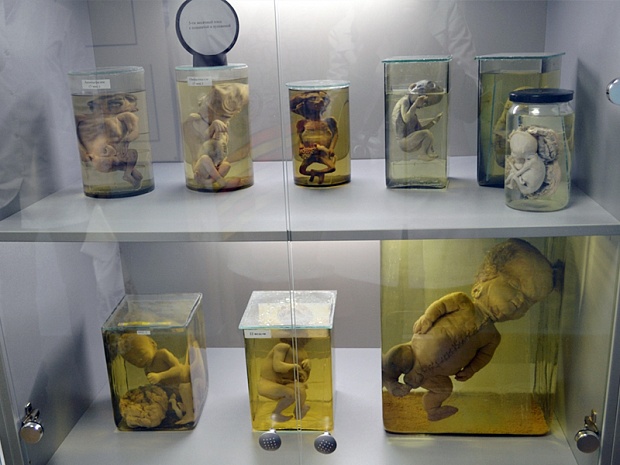 Музей анатомии человека при ИрГМА (Иркутск)
